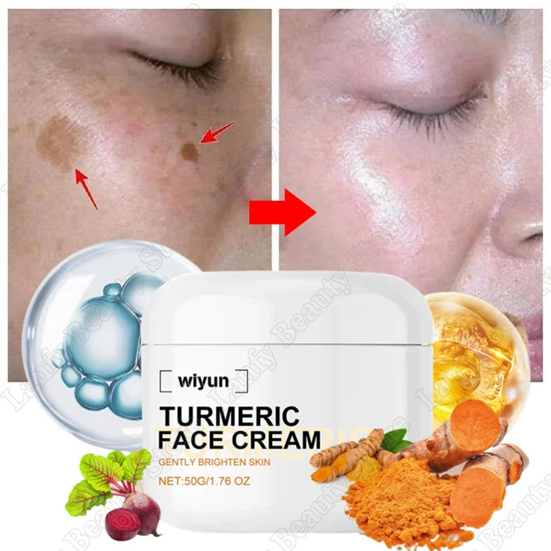 Rétinol naturel curcuma vitamine C crème blanchissante pour le visage hydratant raffermissant hyaluronique éclaircissant estompe les ridules soins de la peau