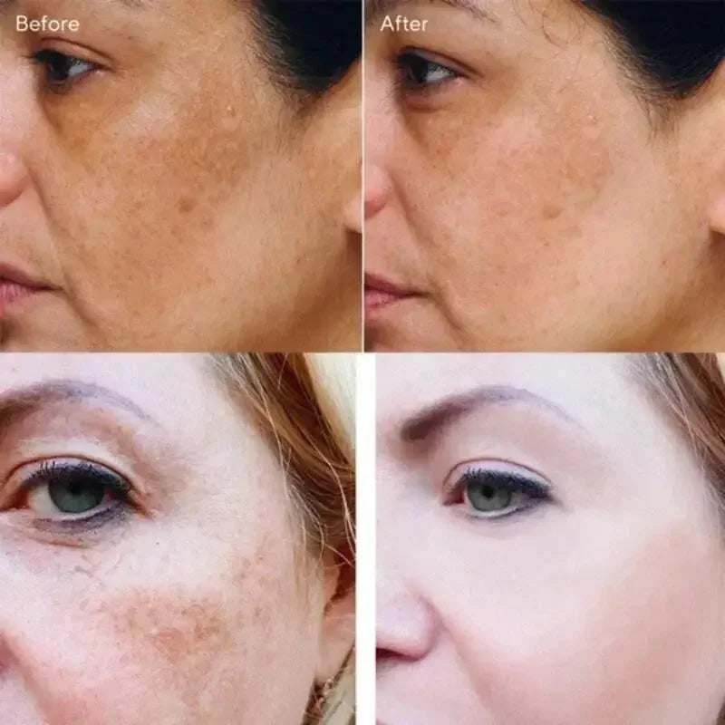 Rétinol naturel curcuma vitamine C crème blanchissante pour le visage hydratant raffermissant hyaluronique éclaircissant estompe les ridules soins de la peau