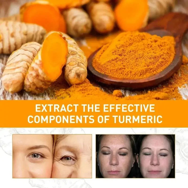 Rétinol naturel curcuma vitamine C crème blanchissante pour le visage hydratant raffermissant hyaluronique éclaircissant estompe les ridules soins de la peau