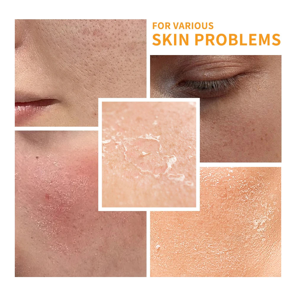 Ensemble de soins pour la peau à la vitamine C, nettoyage en profondeur, crème pour le visage, hydratante, Anti-rides, Kit de soins pour le visage, boîte cadeau, 6 pièces/ensemble