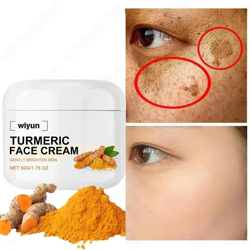 Rétinol naturel curcuma vitamine C crème blanchissante pour le visage hydratant raffermissant hyaluronique éclaircissant estompe les ridules soins de la peau