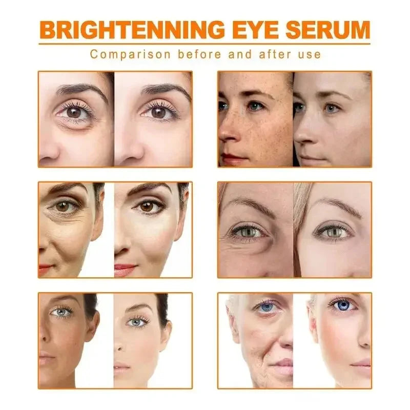 Rétinol naturel curcuma vitamine C crème blanchissante pour le visage hydratant raffermissant hyaluronique éclaircissant estompe les ridules soins de la peau