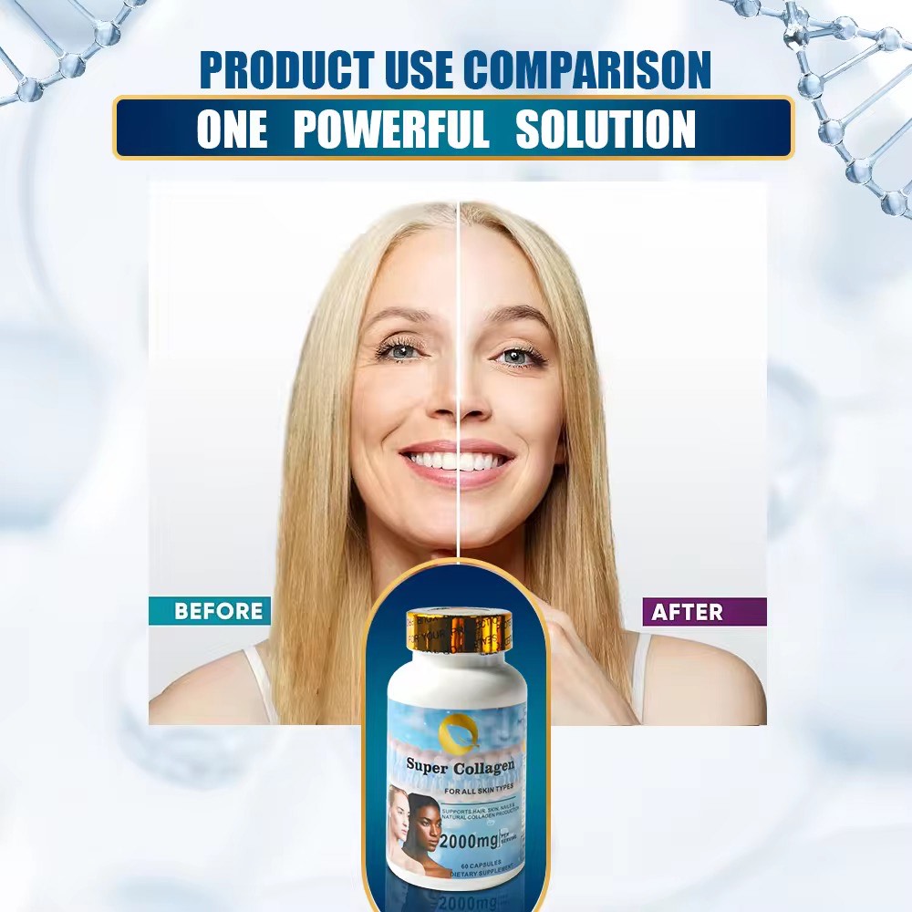Super collagène acide hyaluronique poudre lot cheveux collagène capsule blanchissant la peau surabondance athion capsules