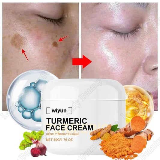 Rétinol naturel curcuma vitamine C crème blanchissante pour le visage hydratant raffermissant hyaluronique éclaircissant estompe les ridules soins de la peau