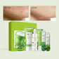 Kit de coffret cadeau thé vert rajeunissement de la peau Essence pour le visage crème pour le visage coréenne estompe les cernes crème pour les yeux produits de soins de la peau 19 pièces
