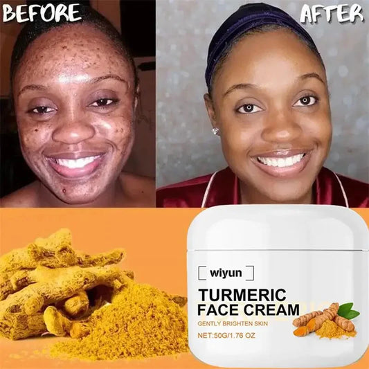Rétinol naturel curcuma vitamine C crème blanchissante pour le visage hydratant raffermissant hyaluronique éclaircissant estompe les ridules soins de la peau